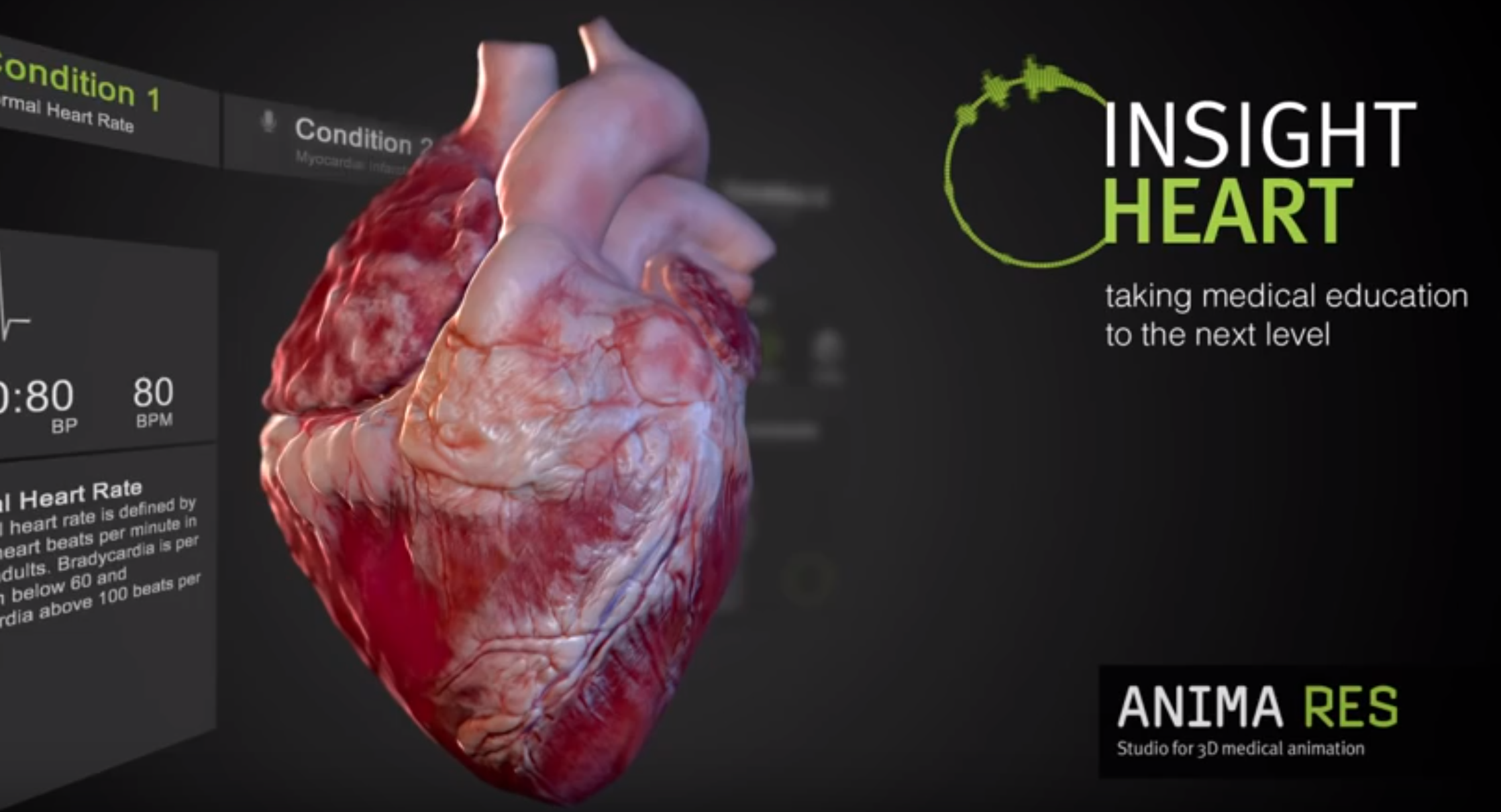 Hololens for Future Surgeons @ Edgewood College